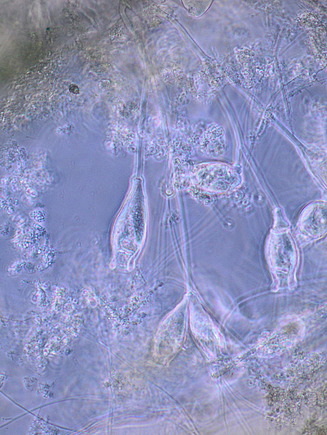 Mikroskopische Ansicht von LINPOR Biofilm-Organismen, die an einer porösen Oberfläche haften. Das Bild zeigt längliche und ovale Mikroorganismen mit feinen Strukturen, die unter starker Vergrößerung aufgenommen wurden.